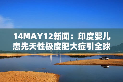 14MAY12新闻：印度婴儿患先天性极度肥大症引全球关注